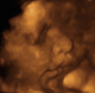 Pregnancy Week image