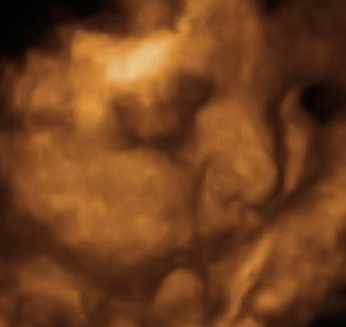 Pregnancy Week image