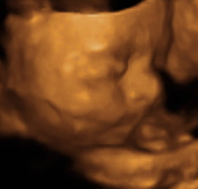Pregnancy Week image