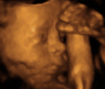 Pregnancy Week image