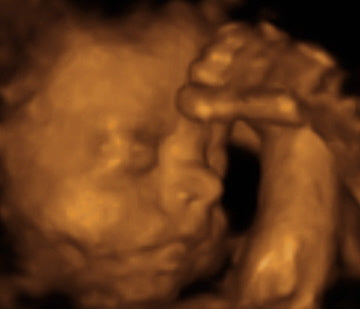 Pregnancy Week image