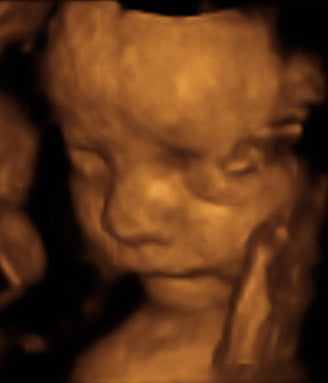 Pregnancy Week image