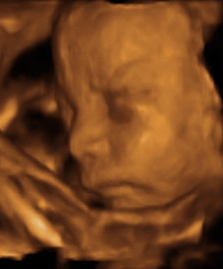 Pregnancy Week image