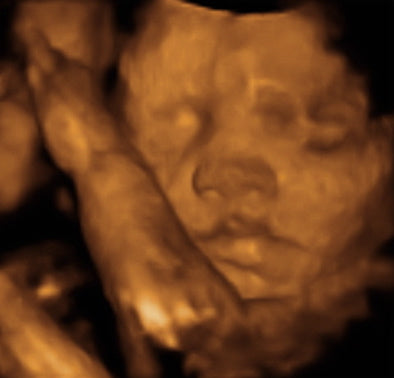 Pregnancy Week image