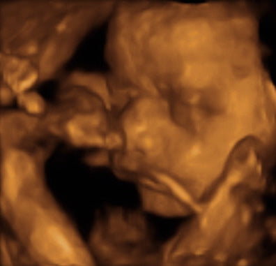 Pregnancy Week image
