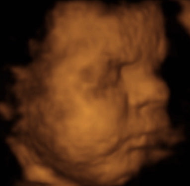 Pregnancy Week image