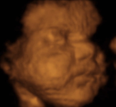 Pregnancy Week image