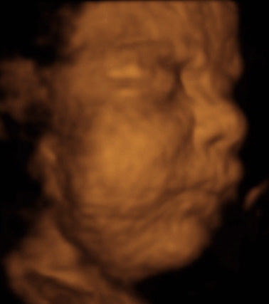 Pregnancy Week image