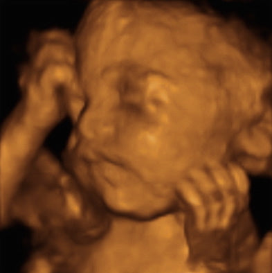 Pregnancy Week image