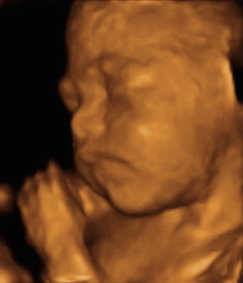 Pregnancy Week image