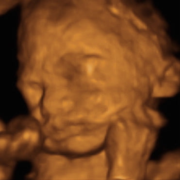 Pregnancy Week image