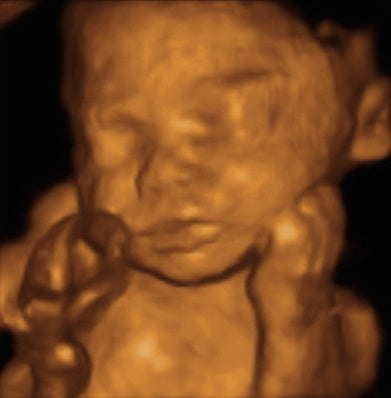 Pregnancy Week image