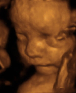 Pregnancy Week image