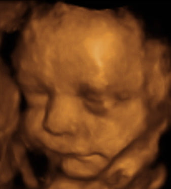 Pregnancy Week image