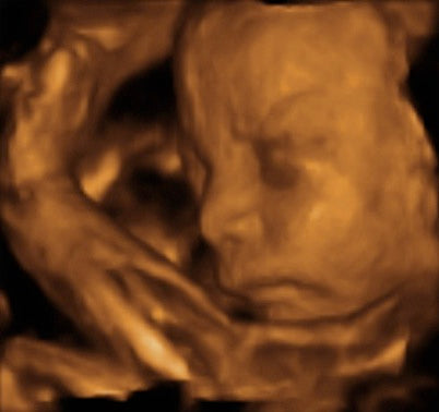 Pregnancy Week image