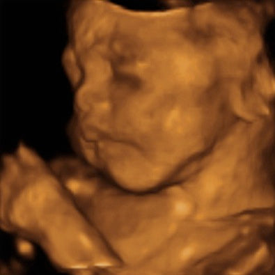 Pregnancy Week image