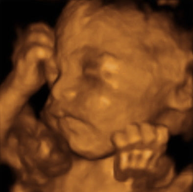Pregnancy Week image