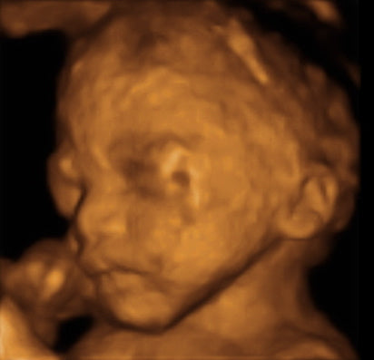 Pregnancy Week image