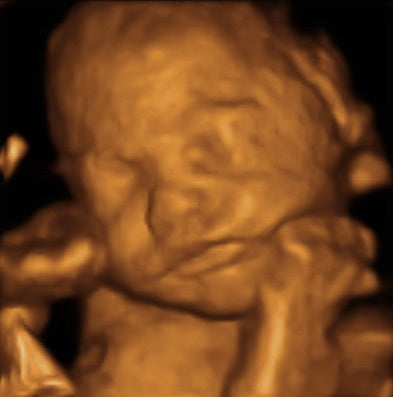 Pregnancy Week image