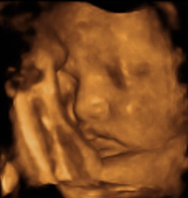 Pregnancy Week image