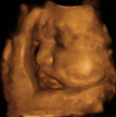 Pregnancy Week image