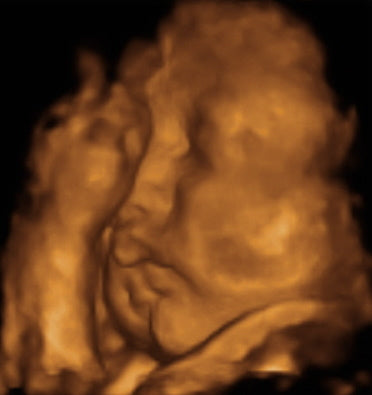 Pregnancy Week image