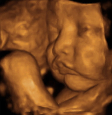 Pregnancy Week image