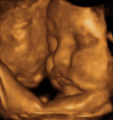 Pregnancy Week image