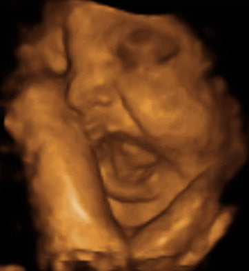 Pregnancy Week image