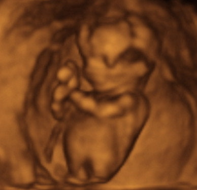 Pregnancy Week image