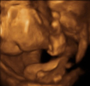 Pregnancy Week image