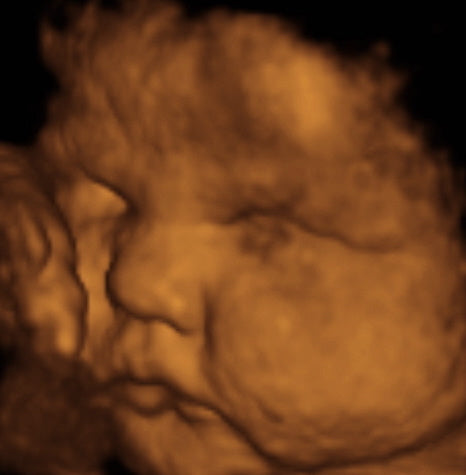 Pregnancy Week image
