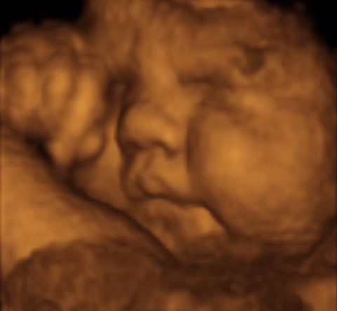 Pregnancy Week image