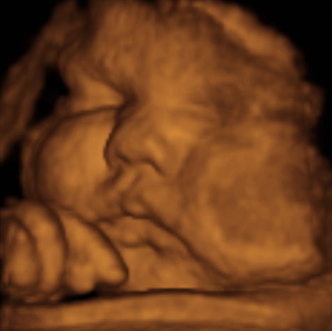 Pregnancy Week image