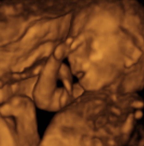 Pregnancy Week image
