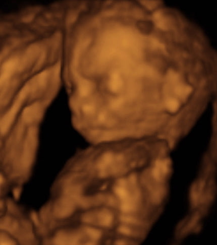 Pregnancy Week image
