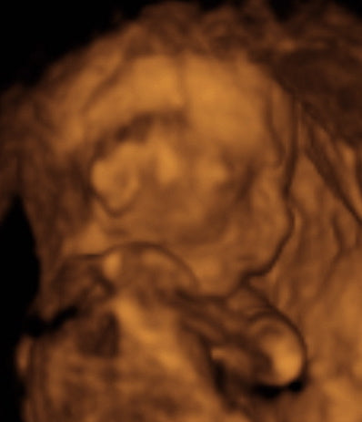 Pregnancy Week image