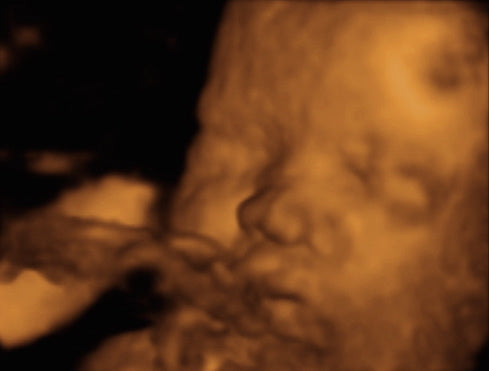 Pregnancy Week image
