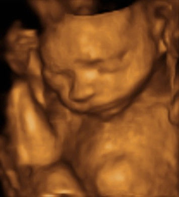 Pregnancy Week image