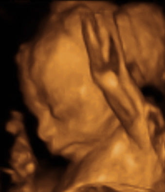Pregnancy Week image