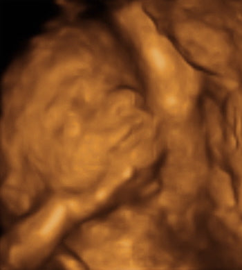 Pregnancy Week image