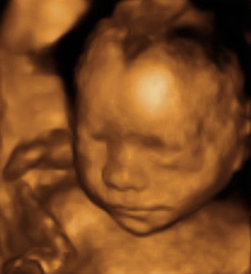 Pregnancy Week image