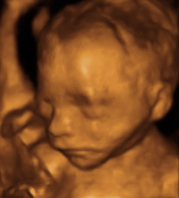 Pregnancy Week image