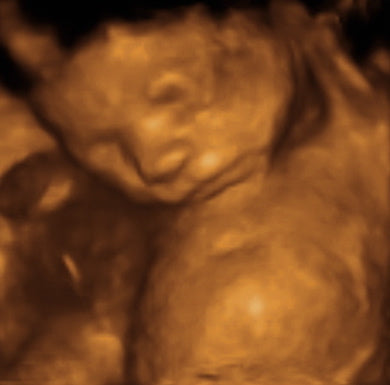 Pregnancy Week image