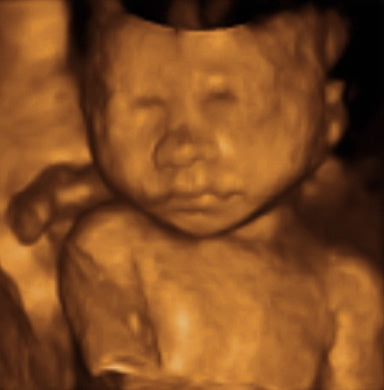 Pregnancy Week image