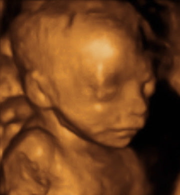 Pregnancy Week image