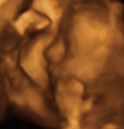 Pregnancy Week image