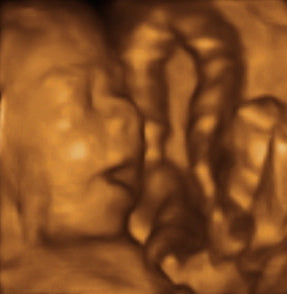 Pregnancy Week image