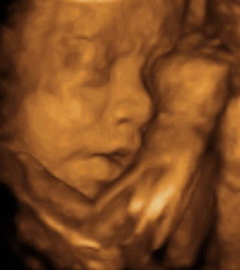 Pregnancy Week image