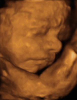 Pregnancy Week image
